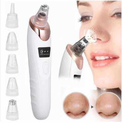 5-in-1 Rechargeable Blackhead Remover Vacuum